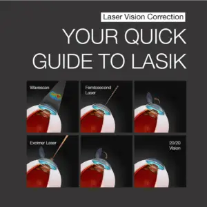 A series of six images illustrating the LASIK eye surgery process: Cornea mapping with a topographical map; Femtosecond laser cutting a corneal flap; Flap being lifted to expose corneal tissue; Excimer laser reshaping the cornea; Flap repositioned over the treated area; Eye with corrected vision, showing 20/20 results.