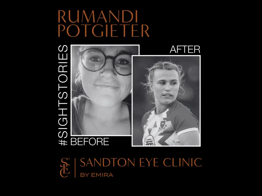 Embracing Clarity: An Athlete's Journey with LASIK Vision Correction 29 Rumandi's before and after LASIK Journey at Sandton Eye Clinic