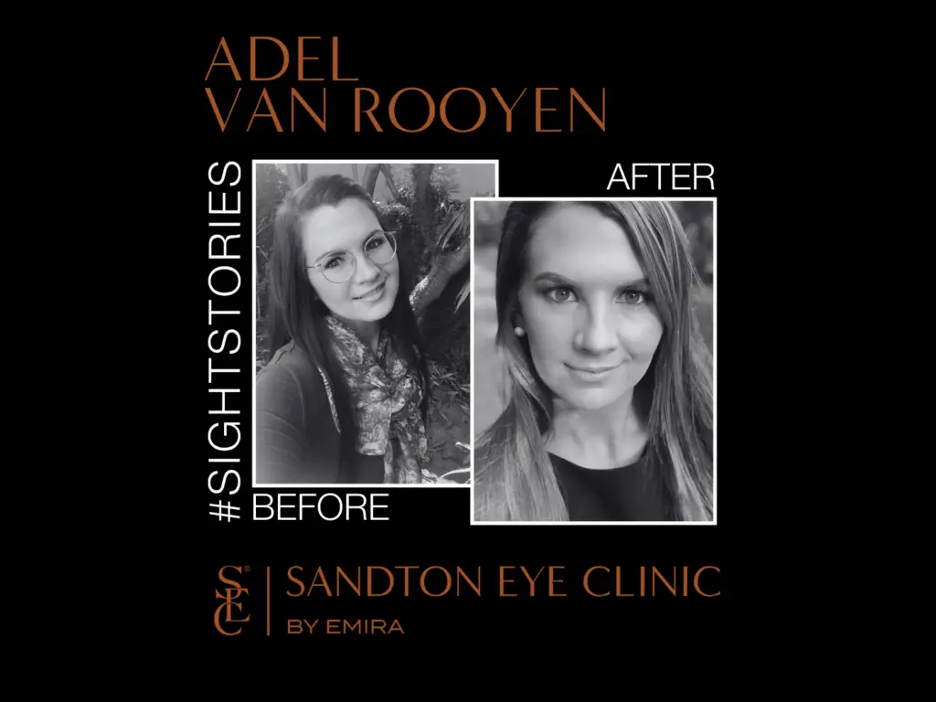 Adel's Before and After LASIK Journey at Sandton Eye Clinic