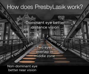 LASIK: See the World as It’s Meant to Be Seen 11 Illustration explaining how PresbyLASIK works by enhancing depth of field in both eyes—optimising the dominant eye for distance vision, the non-dominant eye for near vision, and creating an overlap zone in the middle for seamless visual focus at various distances.