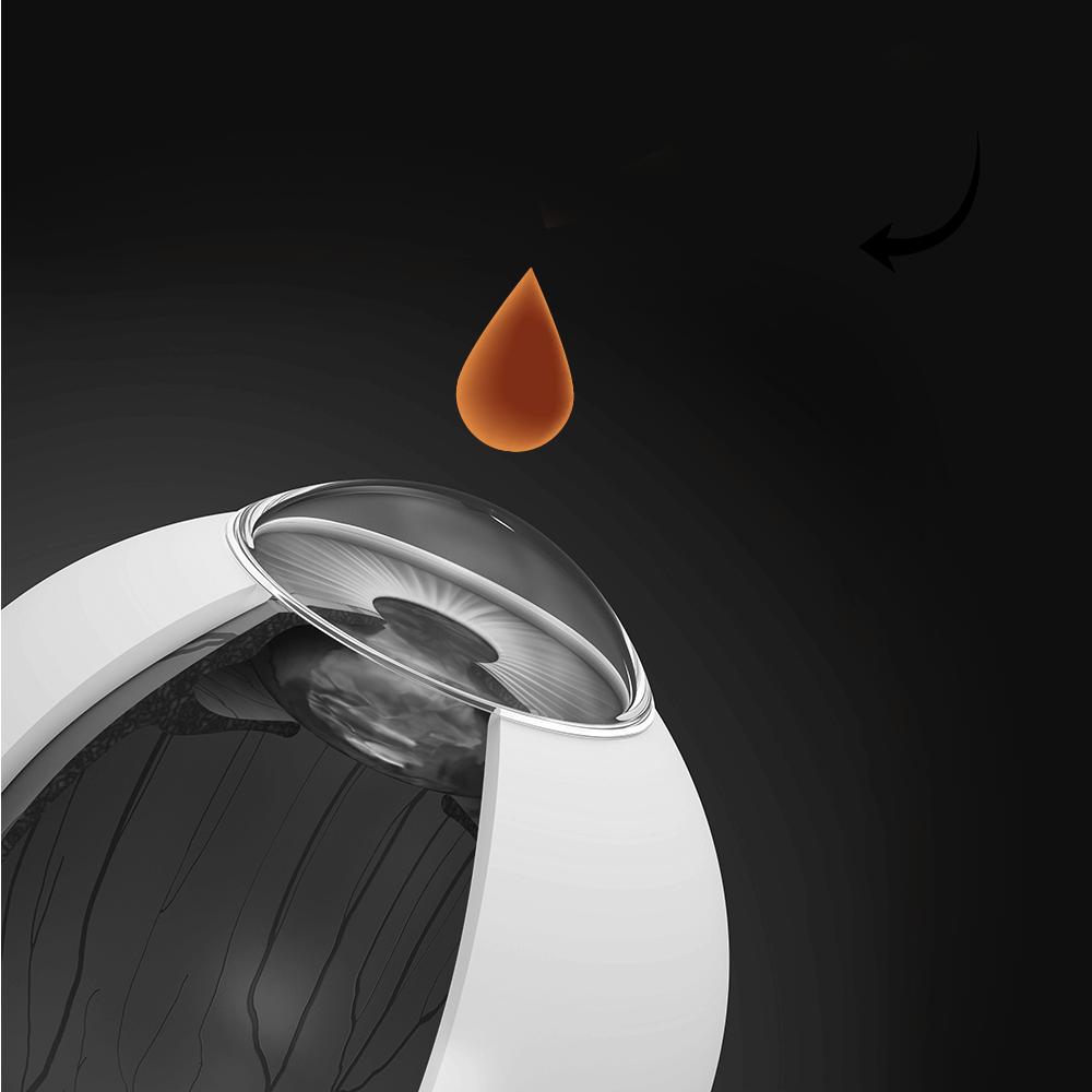 LASIK: See the World as It’s Meant to Be Seen 6 Illustration of an eye receiving numbing eye drops before LASIK surgery, preparing the patient for a comfortable and pain-free procedure.